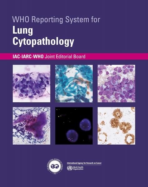 WHO Reporting System for Lung Cytopathology (WHO Reporting Systems for Cytopathology, 1) 2023 - فرهنگ عمومی و لوازم تحریر